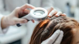 Haartransplantation für Frauen: Langfristige Option im Fokus